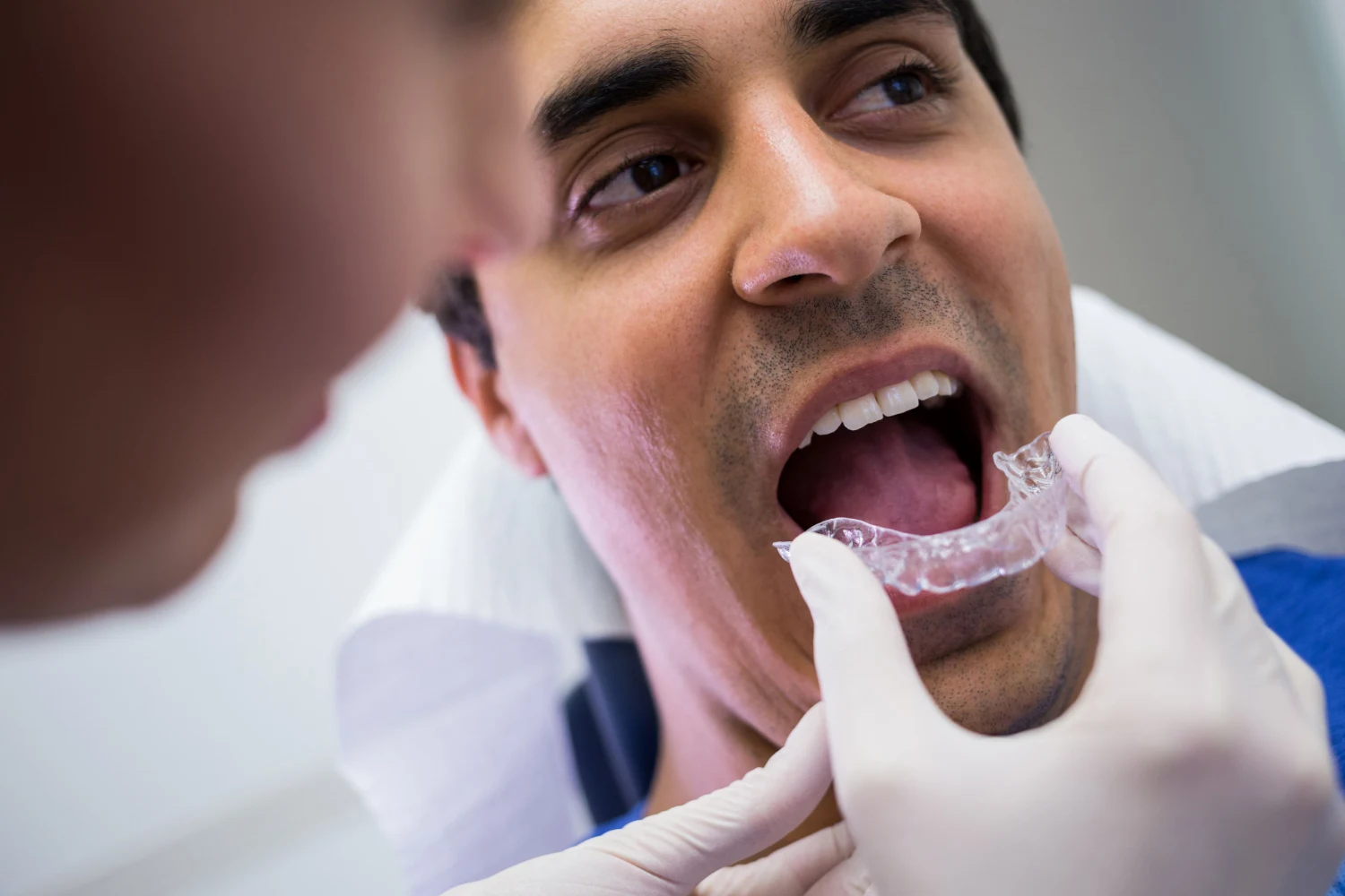 dental guards night vs sports