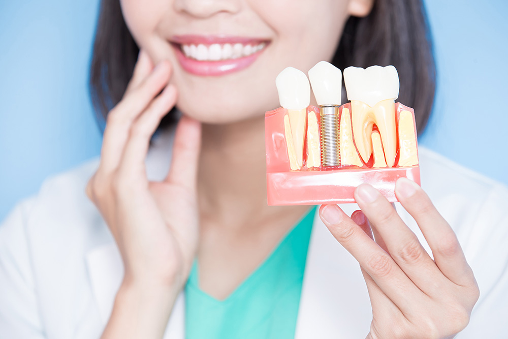 dental implants in colwood