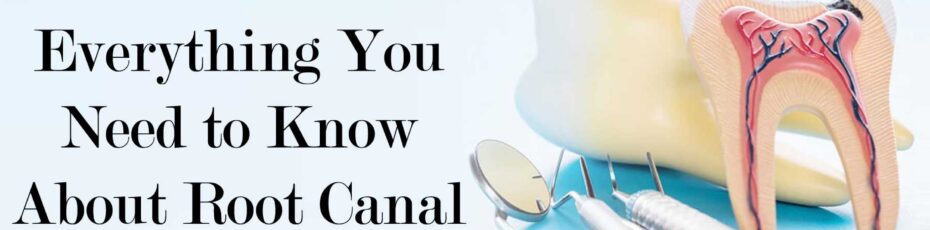 Everything You Need to Know About Root Canal Treatment