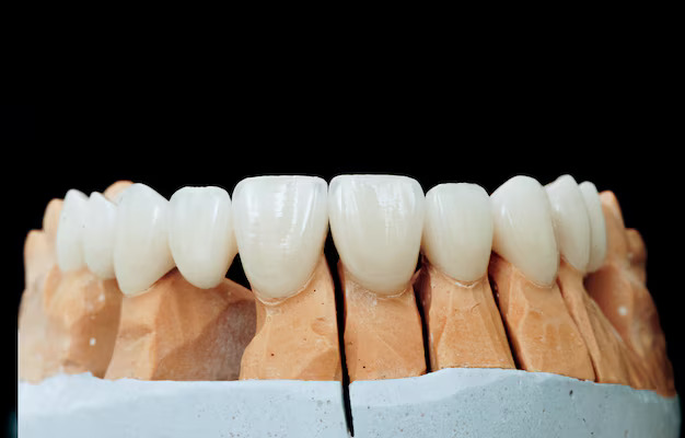 ceramic-teeth-with-implant-plaster-model