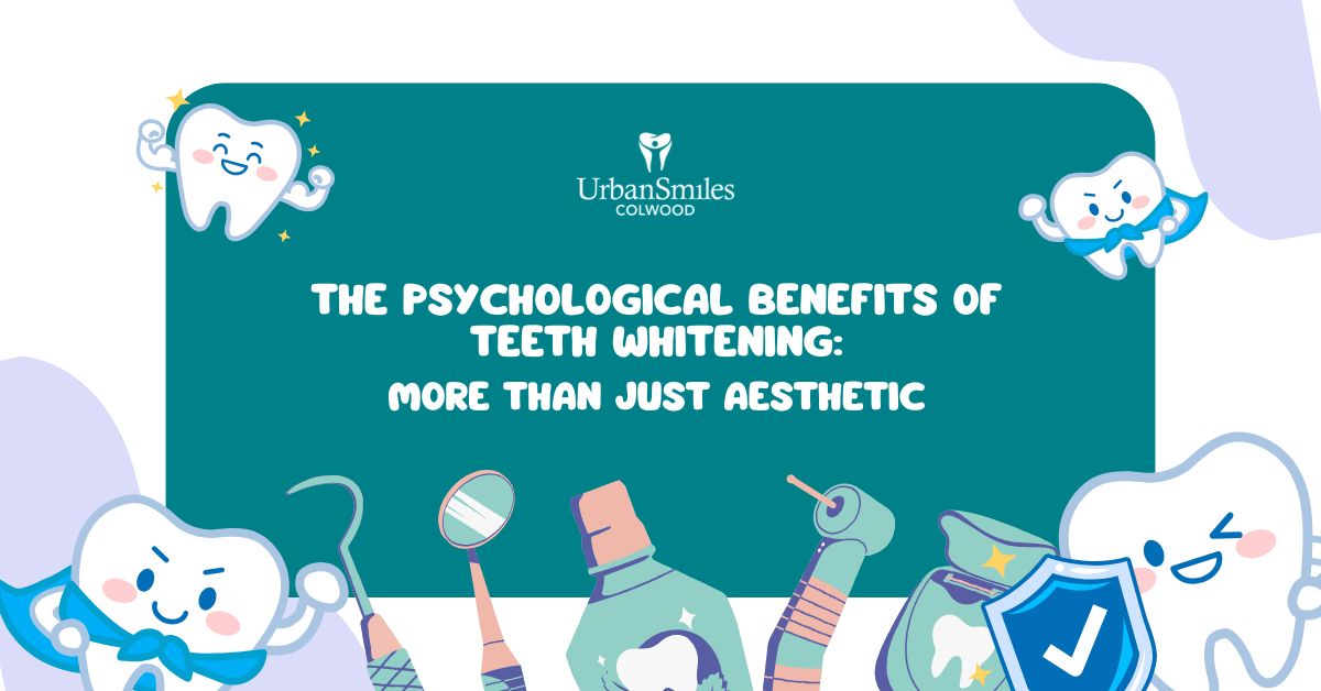 The Psychological Benefits of Teeth Whitening: More Than Just Aesthetic