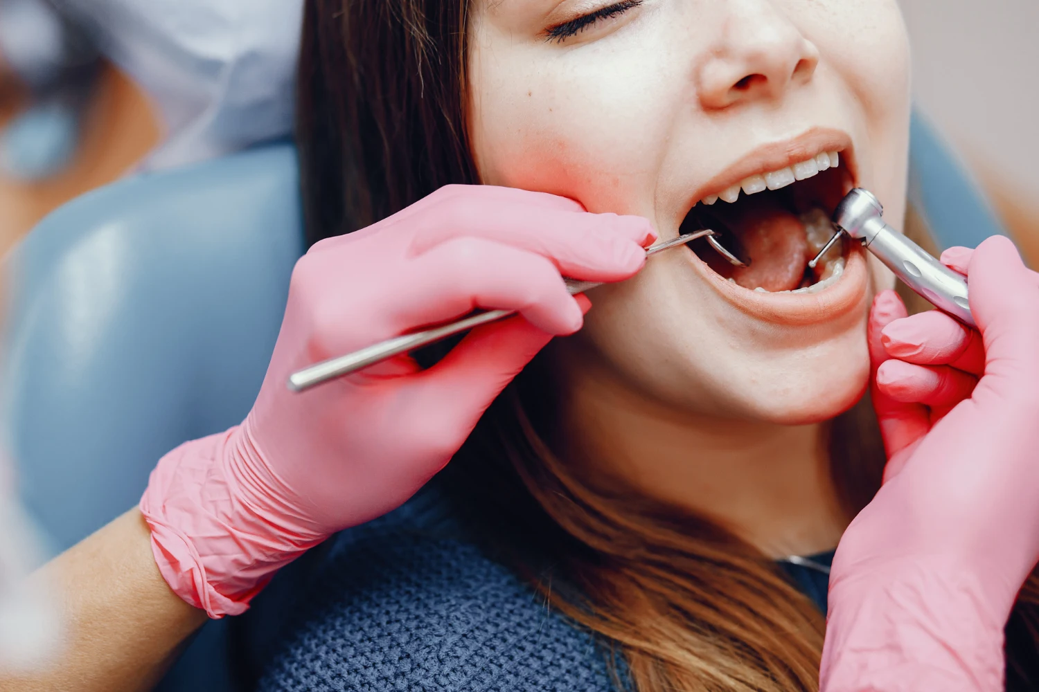 types of dental fillings explained