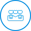 Dental Bridges